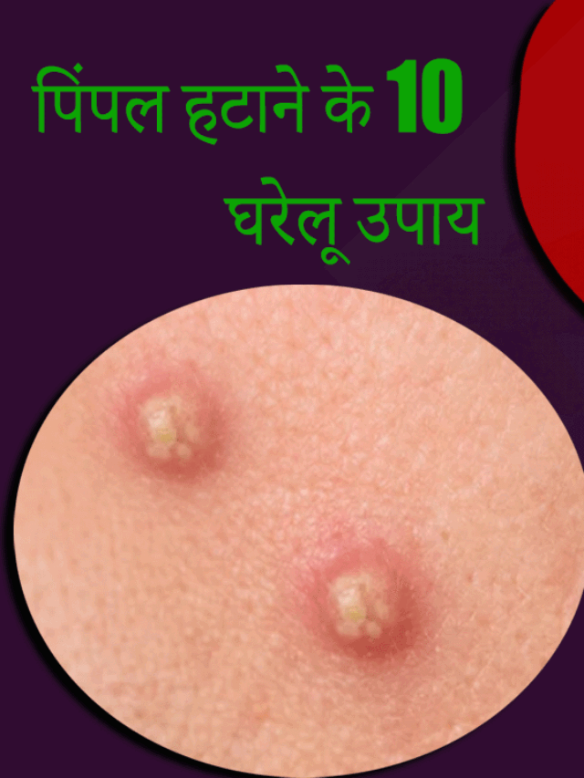 pimple kaise hataye gharelu nuskhe