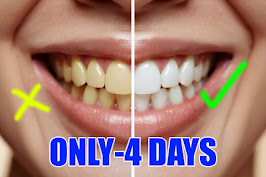पीले दांतो को सफेद करने के लिए कुछ आसान उपाय और आयुर्वेदिक ! घरेलू नुस्खे || teeth care tips in hindi 1
peele daanto ko saphed karane ke lie kuchh aasaan upaay