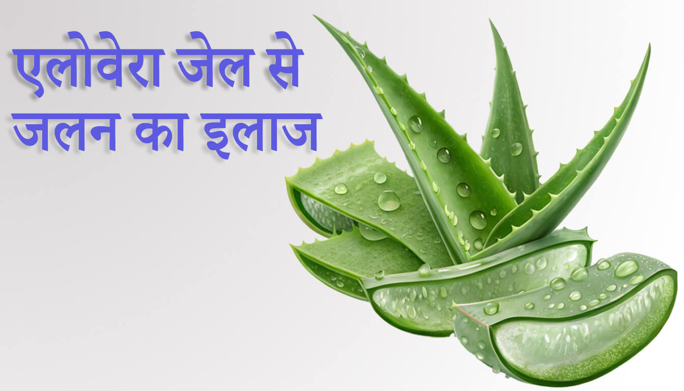 aloe-vera-gel-se-jalan-ka-gharelu-ilaj